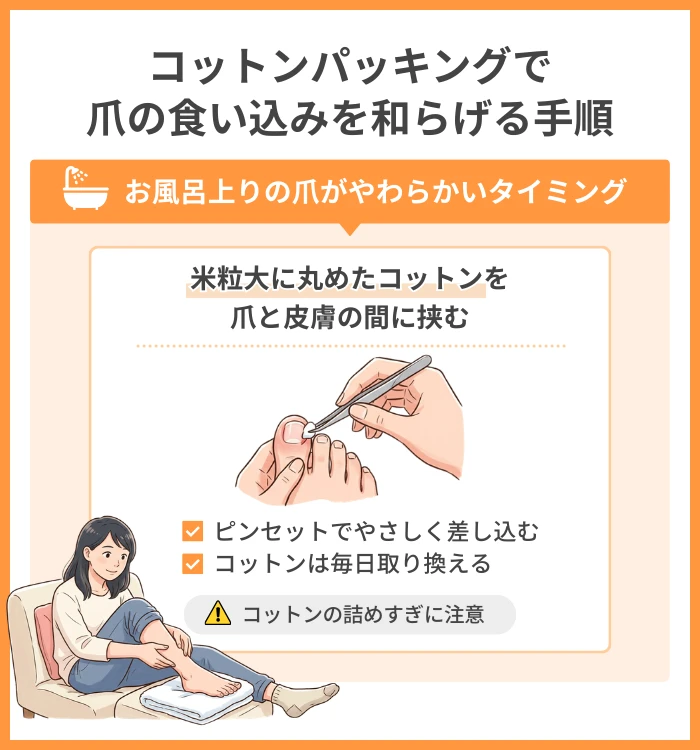 コットンパッキングで爪の食い込みを和らげる手順