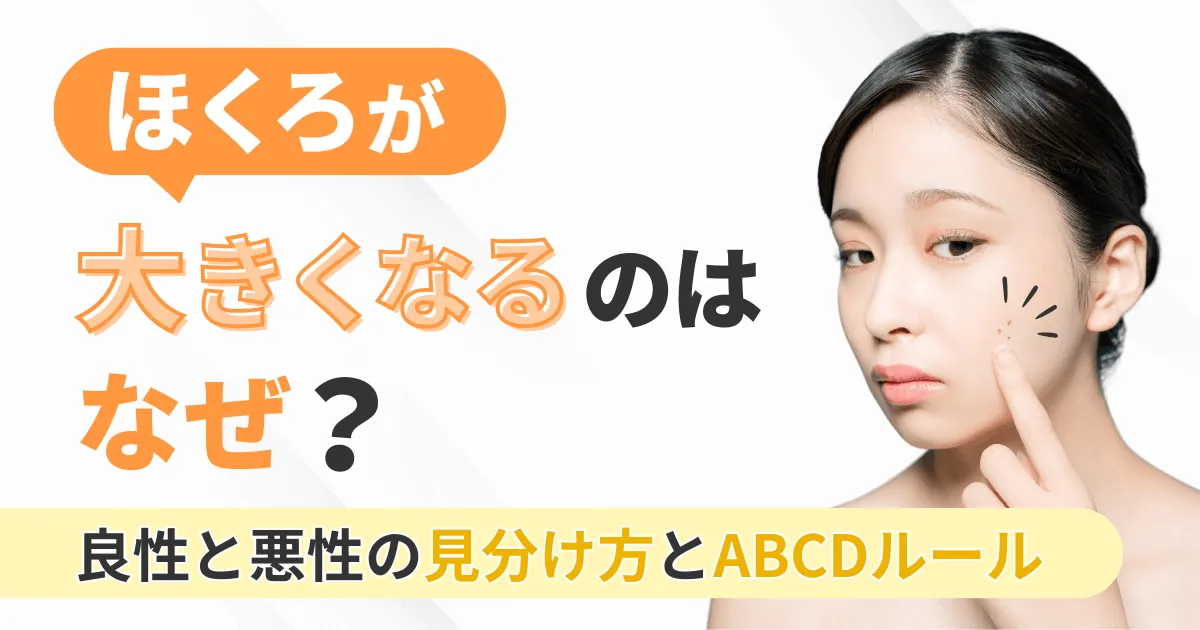 ほくろが大きくなるのはなぜ？良性と悪性の見分け方とABCDルール