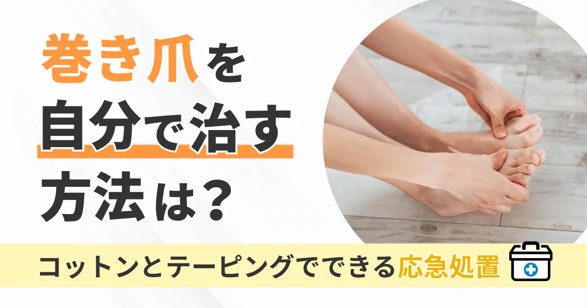 巻き爪を自分で治す方法は?コットンとテーピングでできる応急処置